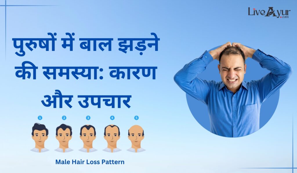 Causes-and-treatment-for-Hair-Loss-in-Men