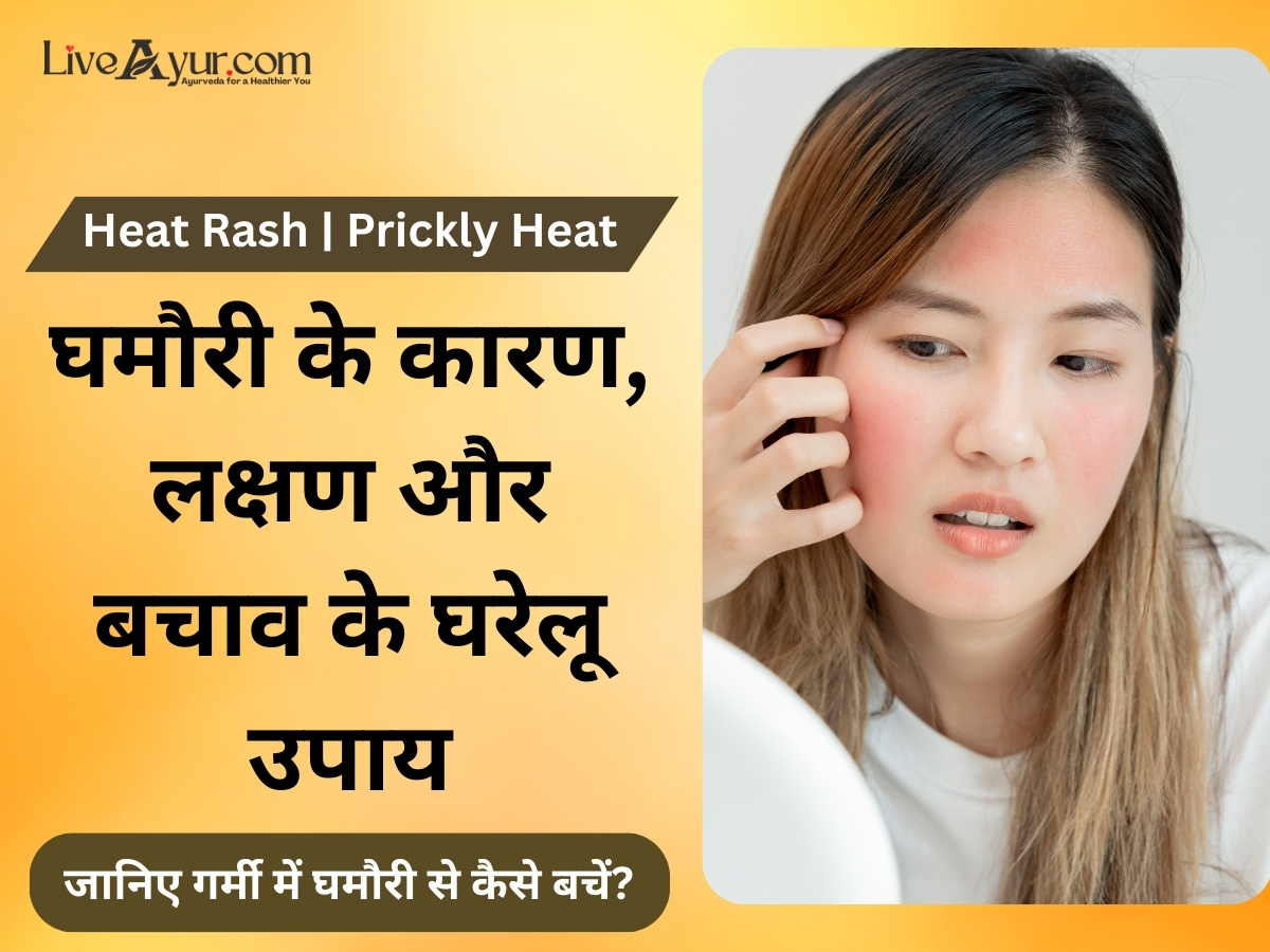 घमौरी के कारण, लक्षण और बचाव: आजमाएं ये 11 असरदार उपाय और पाएं घमौरियों से आराम